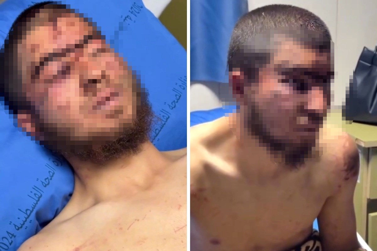 Palestinac: Doseljenici su me oteli i tukli, ujutro me ostavili na cesti bez svijesti