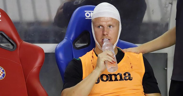 Uhićen navijač koji je igrača Istre na Poljudu pogodio bocom u glavu