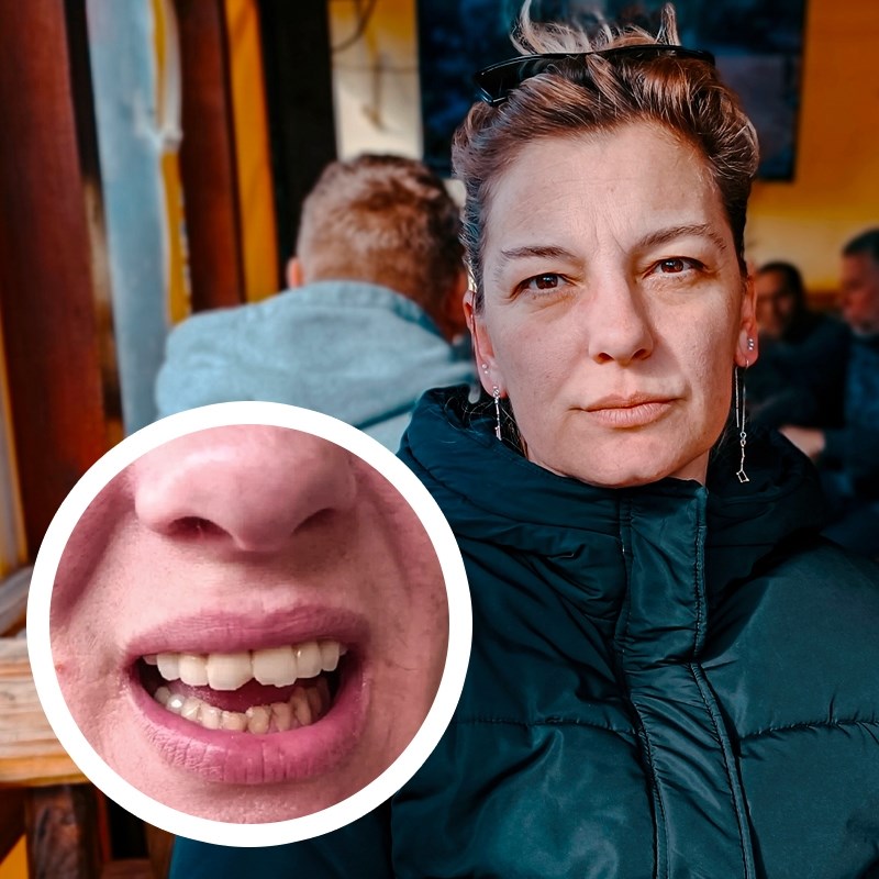 Pacijentici endoskopom razbili zube. KBC Split: Sve je po pravilima struke
