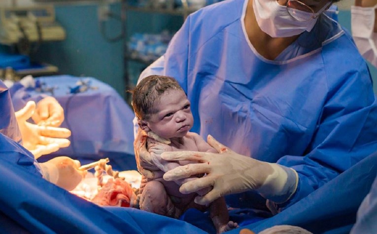 Fotografija tek rođene bebe postala hit zbog face koju je napravila