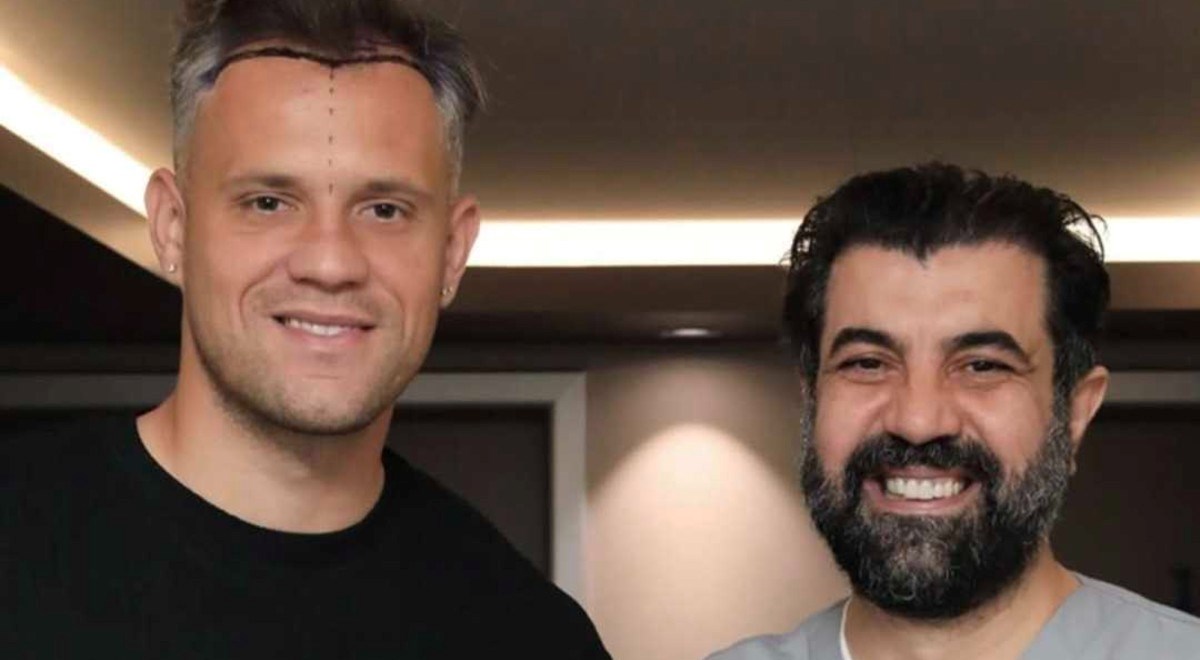 Lučić otišao na presađivanje kose kod istog doktora kod kojeg je išao i Rakitić