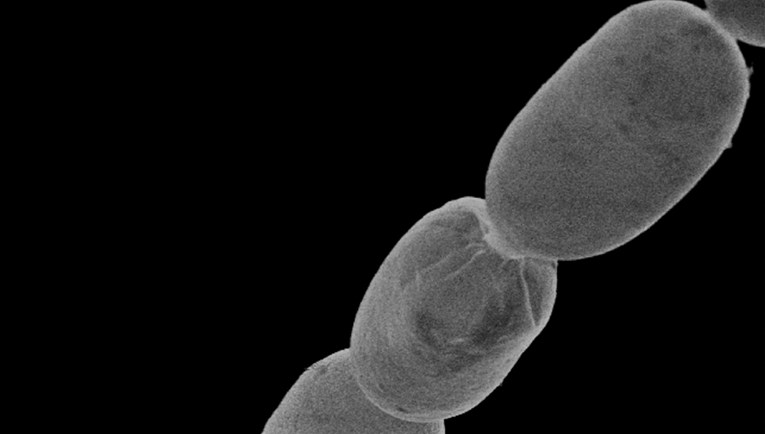 Pronađena najveća bakterija na svijetu