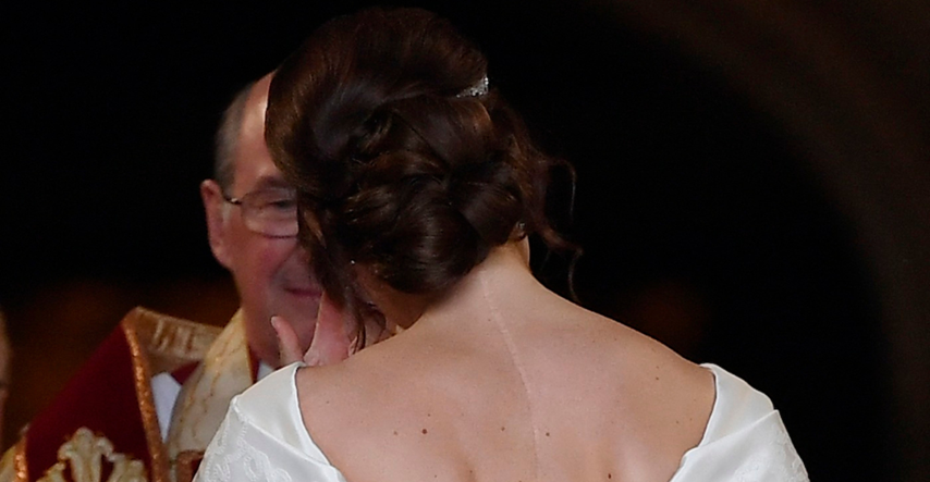 Princeza Eugenie: Namjerno sam nosila vjenčanicu otvorenih leđa da pokažem ožiljak