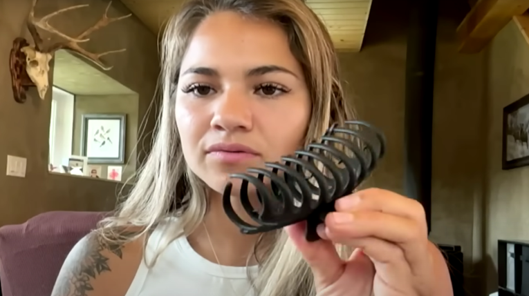 Kanađanku napao medvjed, preživjela je s 30 šavova. "Spasila me kopča za kosu"