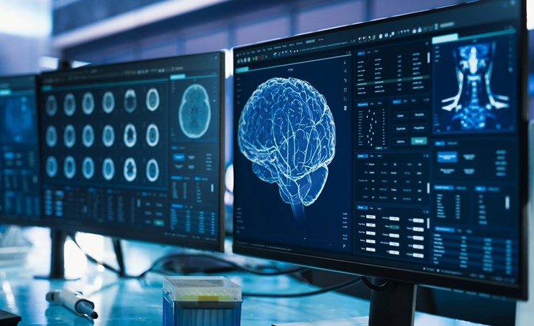 Dopamin u našem mozgu ne funkcionira baš onako kako smo mislili