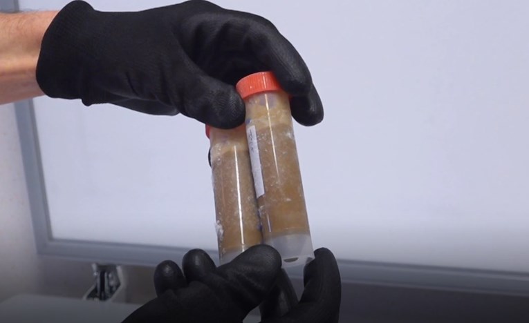 Antibiotici uništavaju crijevnu floru, a švedsko rješenje je - izmet u kapsulama