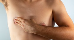 Rak dojke javlja se i kod muškaraca. Evo simptoma koji to otkrivaju