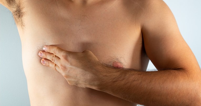 Rak dojke javlja se i kod muškaraca. Evo simptoma koji to otkrivaju