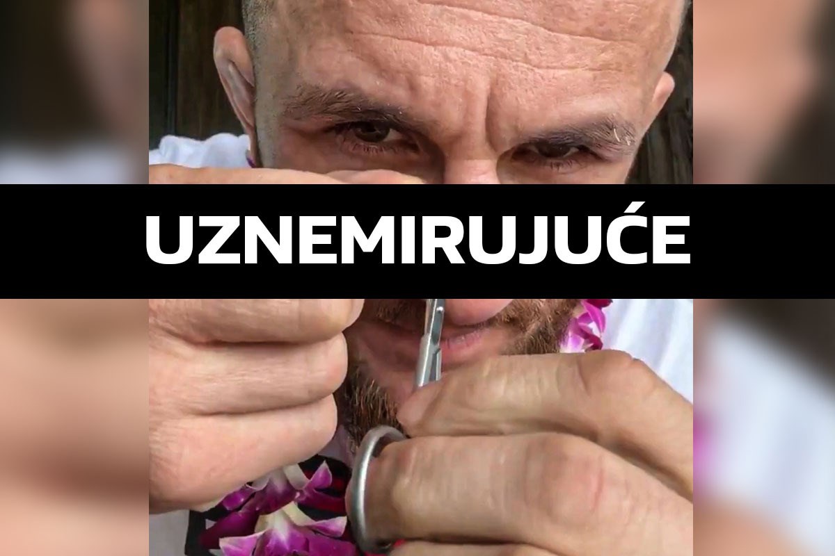 VIDEO UFC-ov borac se snimao kako si sam vadi šavove nakon ozljede. Fanovi u šoku