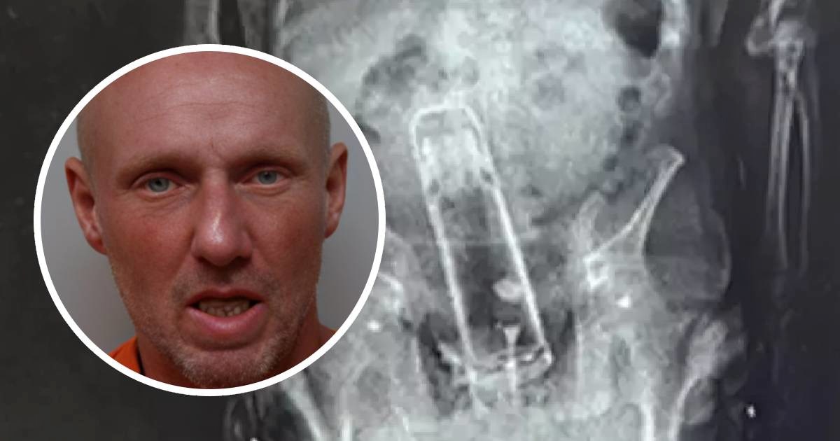 Na Floridi uhitili muškarca pa otkrili da je u stražnjici sakrio termosicu