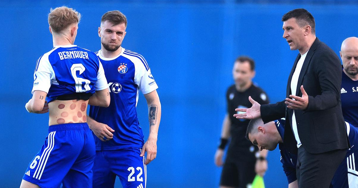 Jakirović ostao bez važnog igrača. Evo kako će Dinamo danas igrati