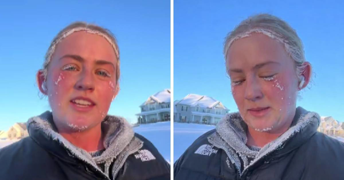 Pokazala je što joj se dogodilo tijekom trčanja na -8°C: "Morala sam na hitnu"