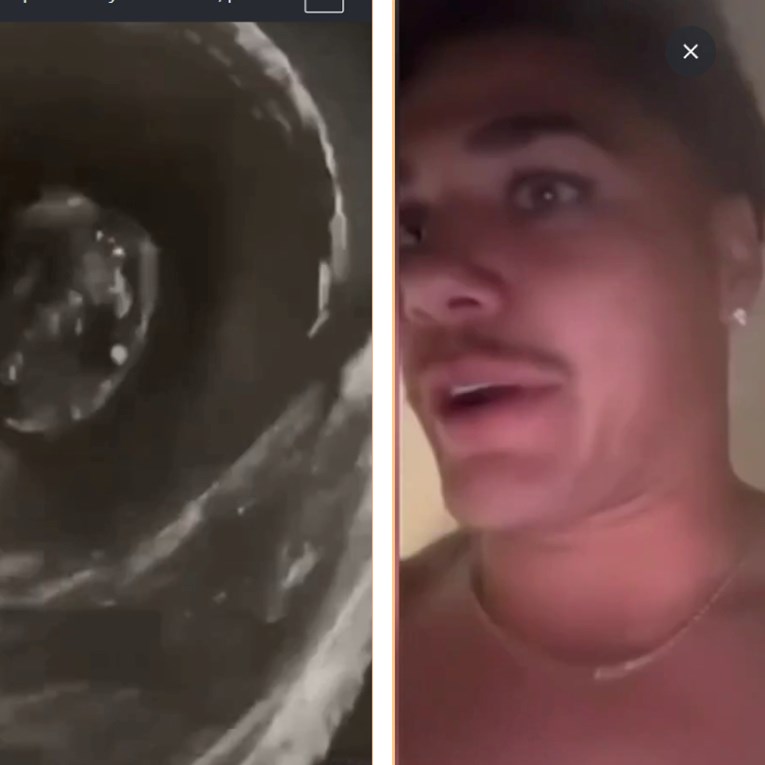 VIDEO Ragbijaš kaže da pije vodu iz WC školjke za oporavak. To je postao opasan trend