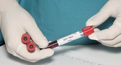 Muškarac (53) iz Njemačke je peta osoba izliječena od HIV-a