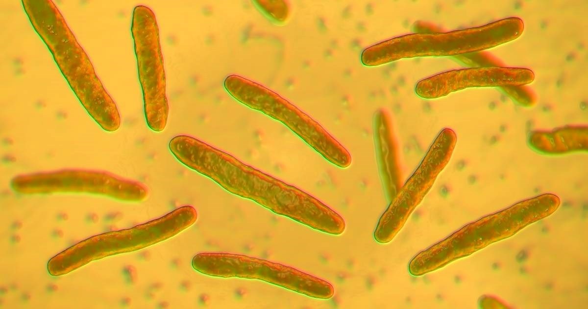 Na Floridi raste broj oboljelih od gube, godišnje u SAD-u bude oko 150 slučajeva