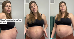 Mama koja je rodila trojke pokazala kako joj je izgledao trbuh nakon porođaja