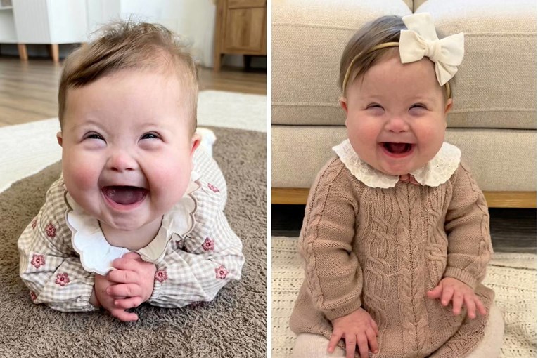 "Ti si posebna": Mama dirljivom porukom mijenja percepciju o Downovom sindromu