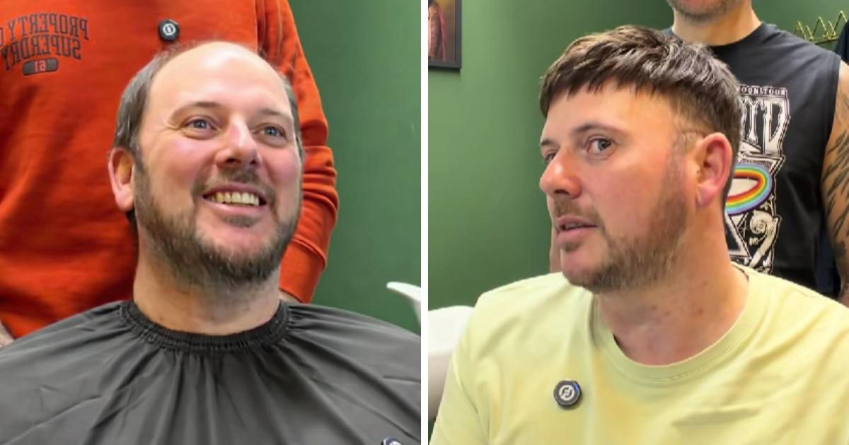 VIDEO Pogledao se u ogledalo nakon umetanja kose i nije mogao vjerovati što vidi