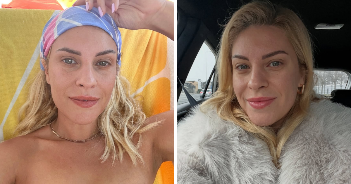 Katarina Baban objavila fotke bez šminke: "Godinama sam se skrivala"