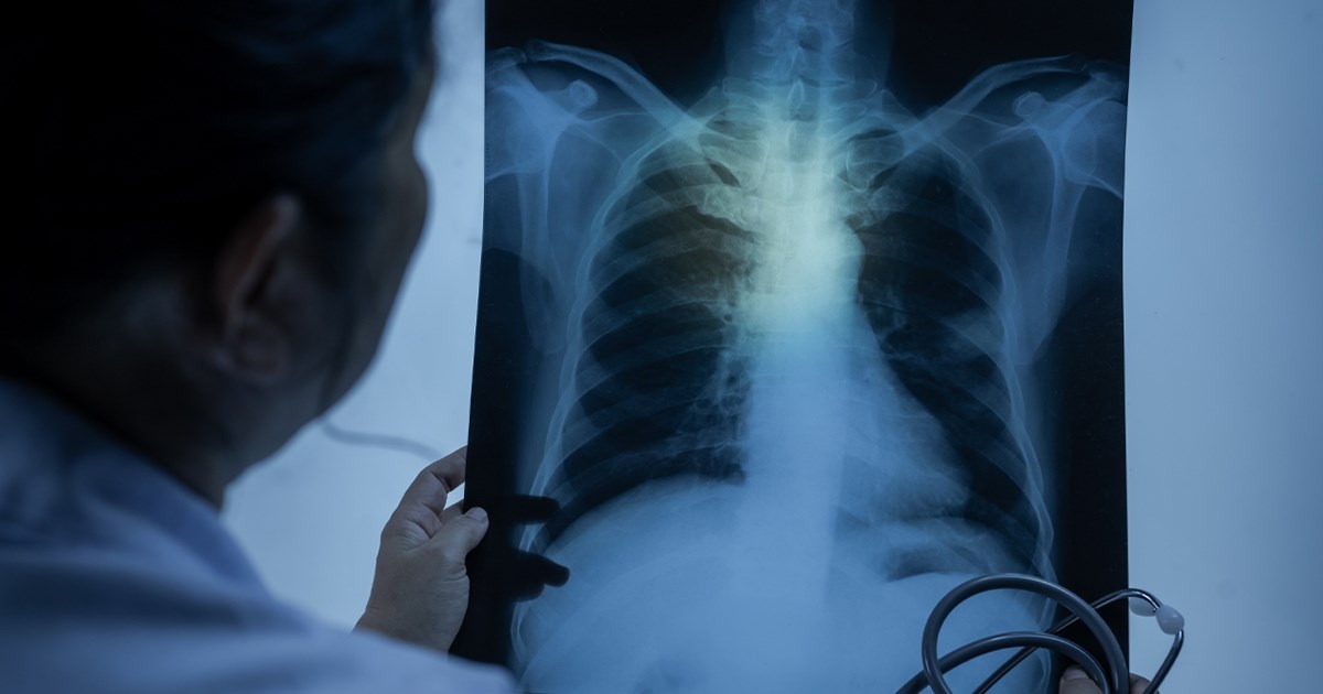 Revolucionarno: Otkrivena terapija koja djeluje na sve vrste raka