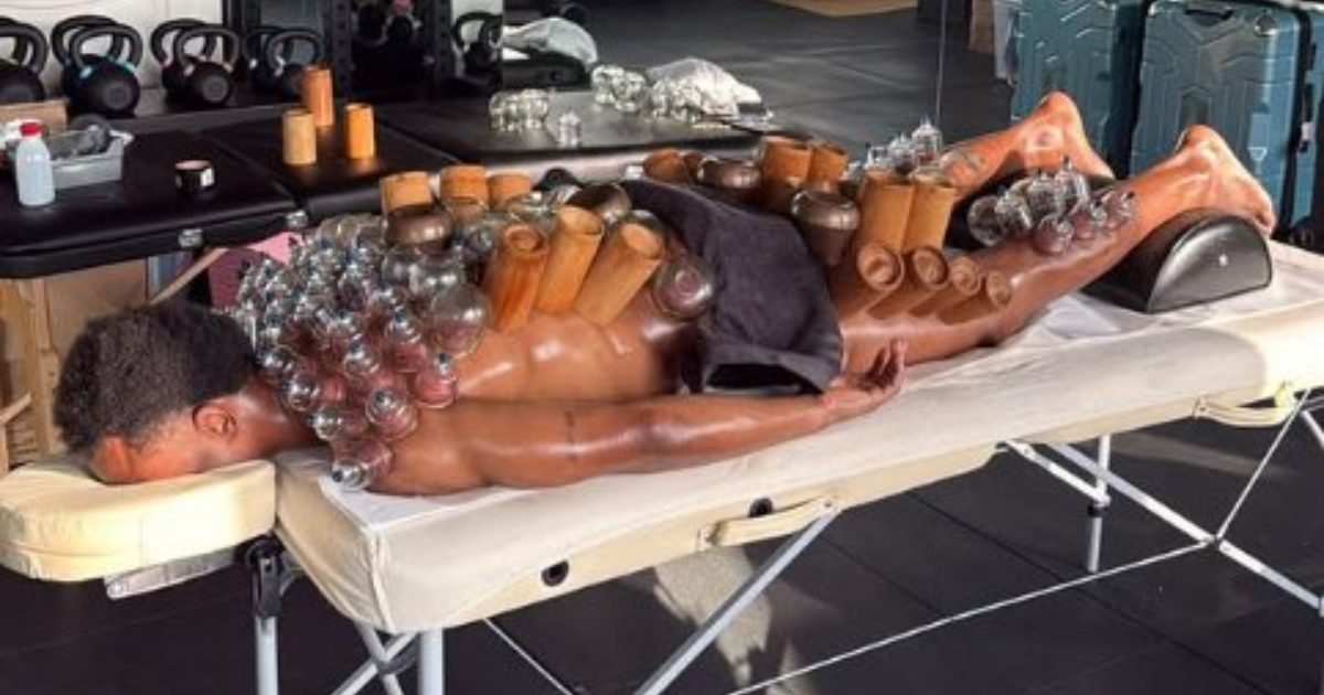 Ova fotografija Juventusove zvijezde u oporavku postala je viralna