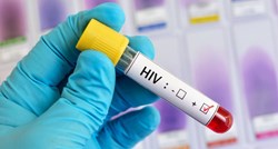 Liječnici: Argentinka se bez lijekova izliječila od HIV-a, imunitet sam uklonio virus