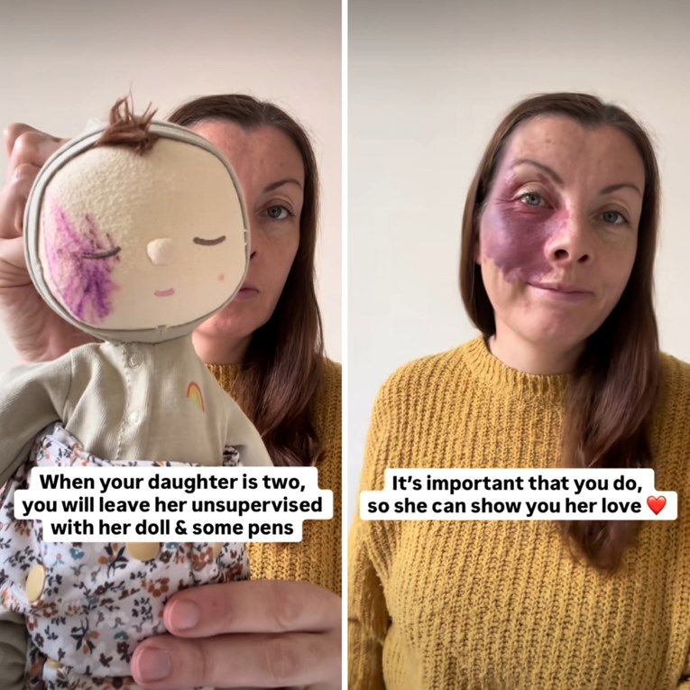 VIDEO Djevojčica nacrtala madež na lutki da izgleda kao njena mama