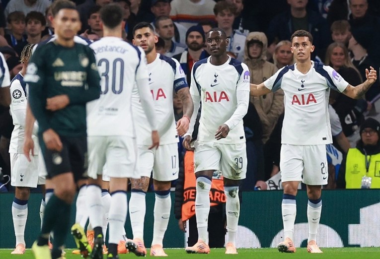 Klinika za presađivanje kose postala sponzor Tottenhama