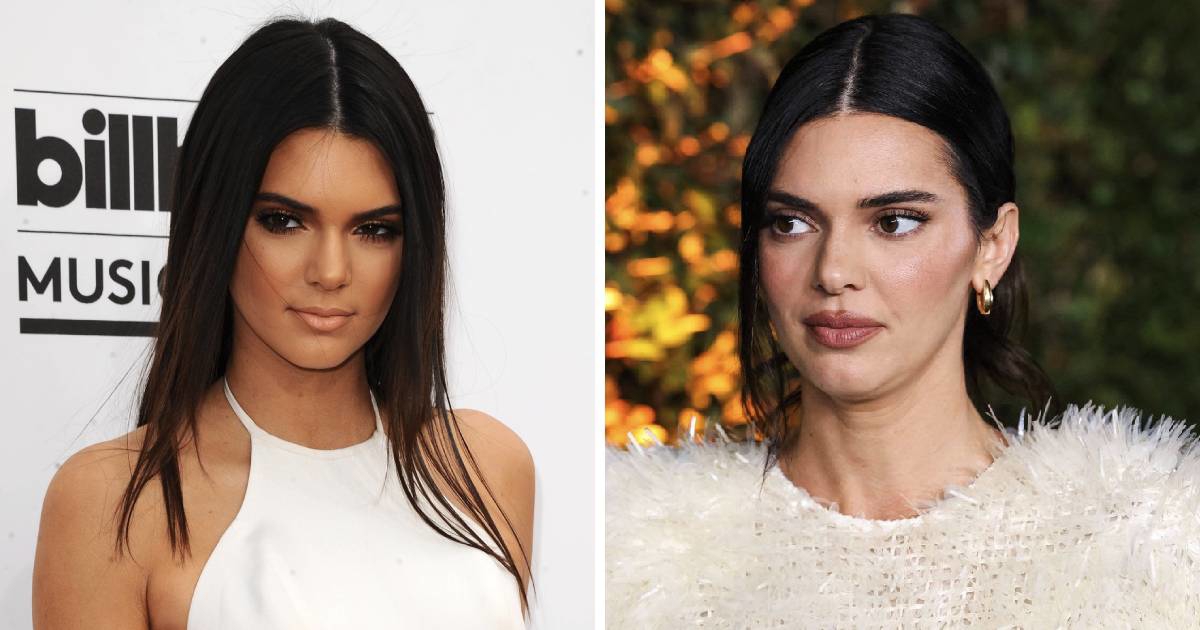 Kendall Jenner osvrnula se na glasine o estetskim operacijama
