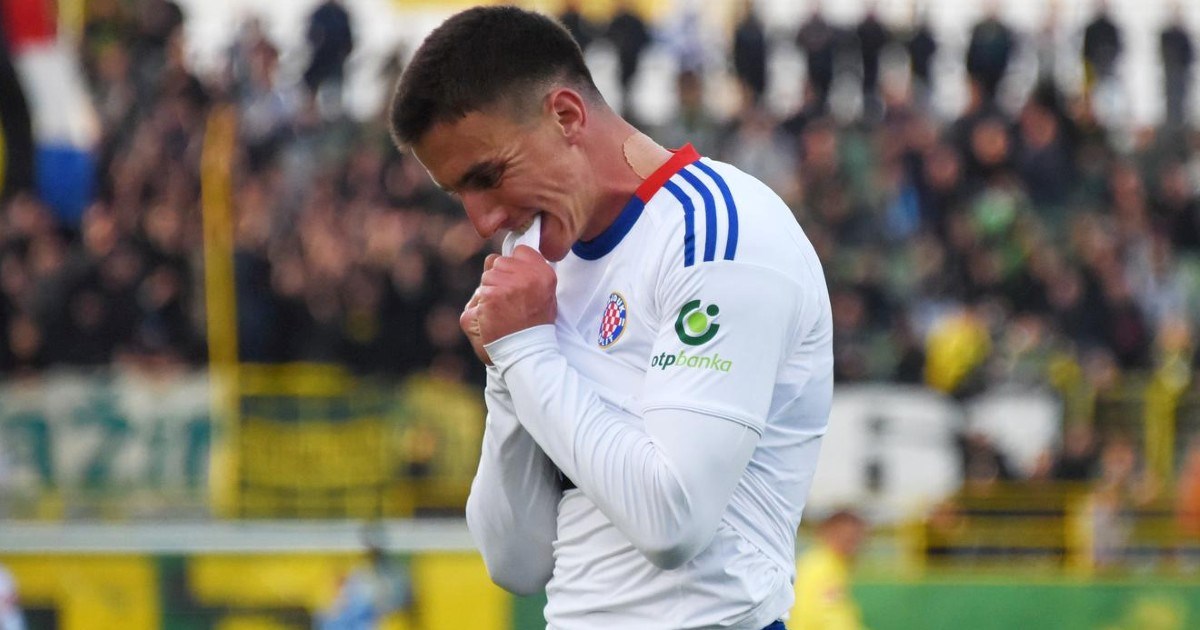 Garcia je s njim eksperimentirao i pogodio. Vi ste ga izabrali za igrača utakmice