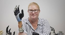 Revolucionarna robotska ruka se spojila s kostima, mišićima i živcima pacijentice
