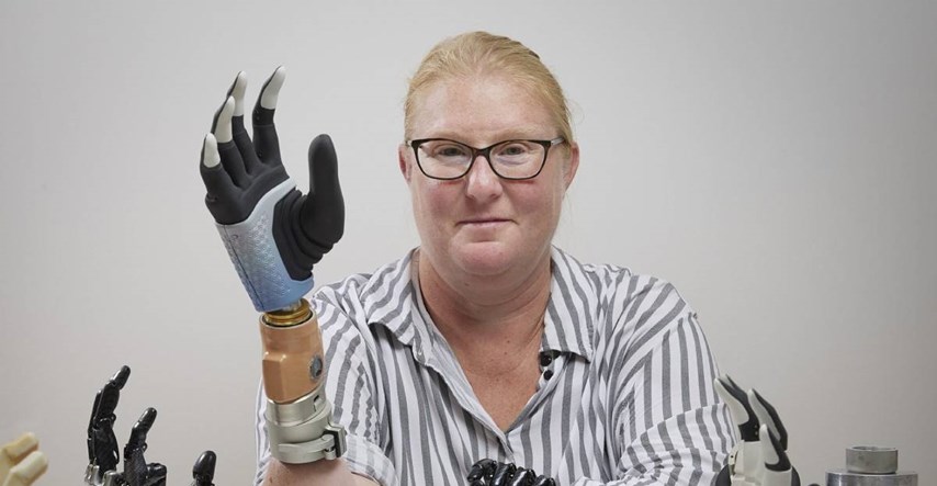 Revolucionarna robotska ruka se spojila s kostima, mišićima i živcima pacijentice