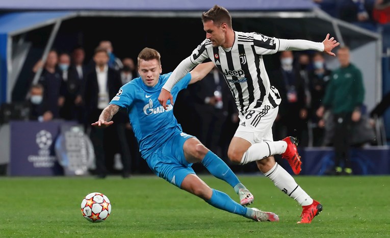 Juventus iziritiran odlukama zvijezde koja je često nedostupna
