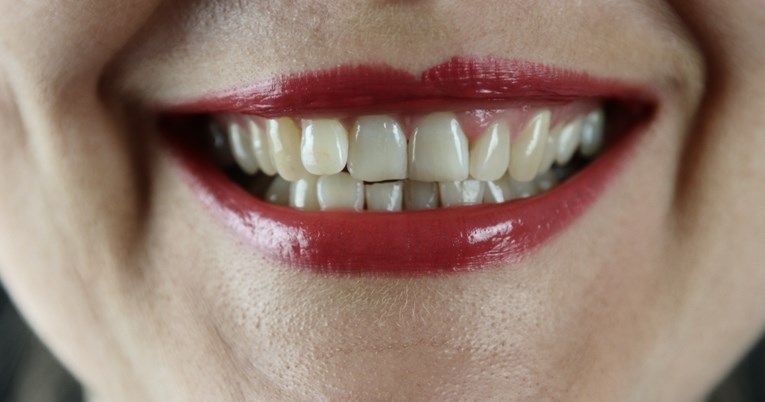 Zubi vam nisu bijeli? Evo koja je hrana najveći krivac za promjenu njihove boje