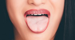 Ako vaš jezik izgleda ovako, jasno je da imate užasan zadah