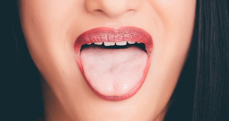 Ako vaš jezik izgleda ovako, jasno je da imate užasan zadah