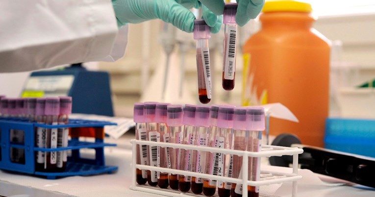 Liječnici otkrili koja krvna grupa ima najmanji rizik od raka