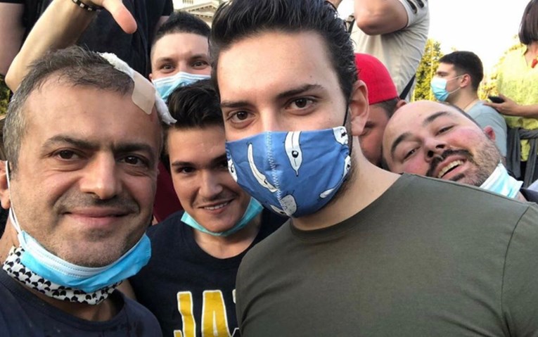 Nakon što su mu razbili glavu na prosvjedima, Trifunović se odmah javio na Instagramu