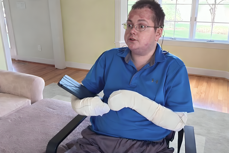 Muškarac rođen sa "sindromom leptira" opisao simptome teške rijetke bolesti