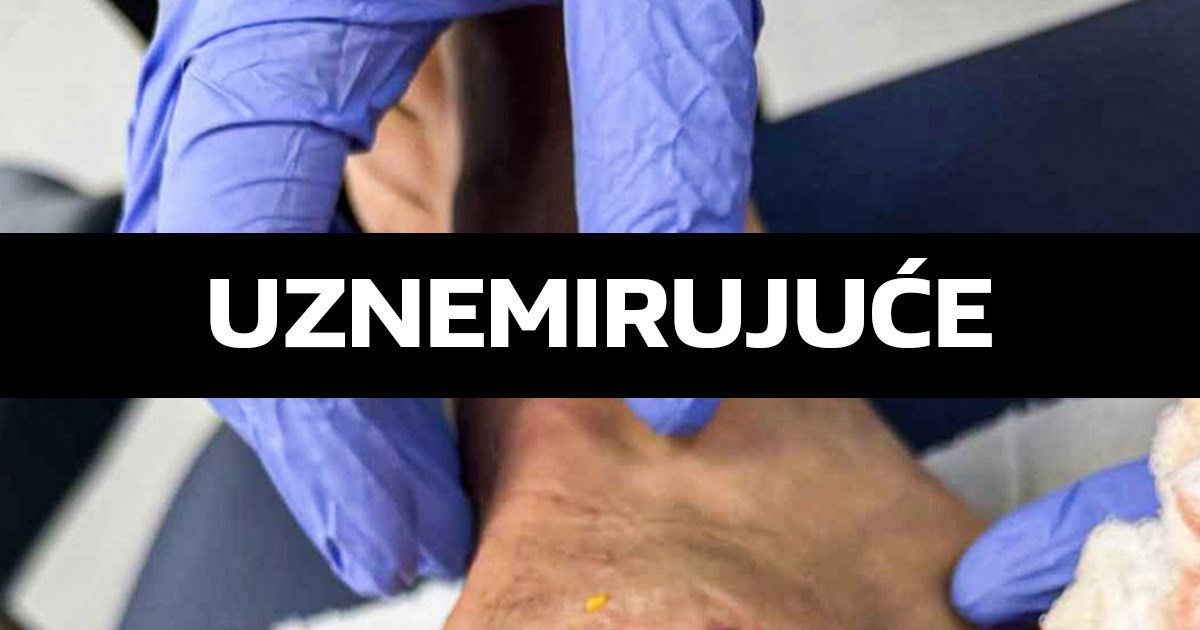 Igrač Aston Ville poludio zbog prekršaja na njemu. Objavio je sliku jezive ozljede