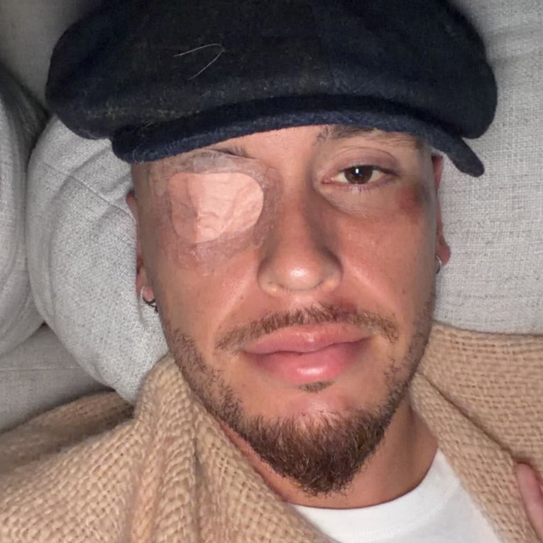 Argentinski napadač bori se s paralizom lica uzrokovanom virusom