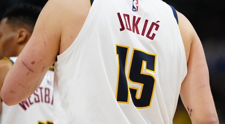 Pogledajte Jokićeve ruke. Ovako izgleda MVP najjače lige