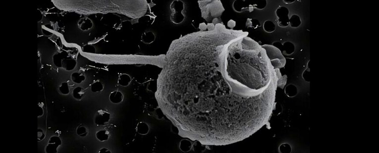 Otkriven divovski virus s najdužim repom ikad viđenim