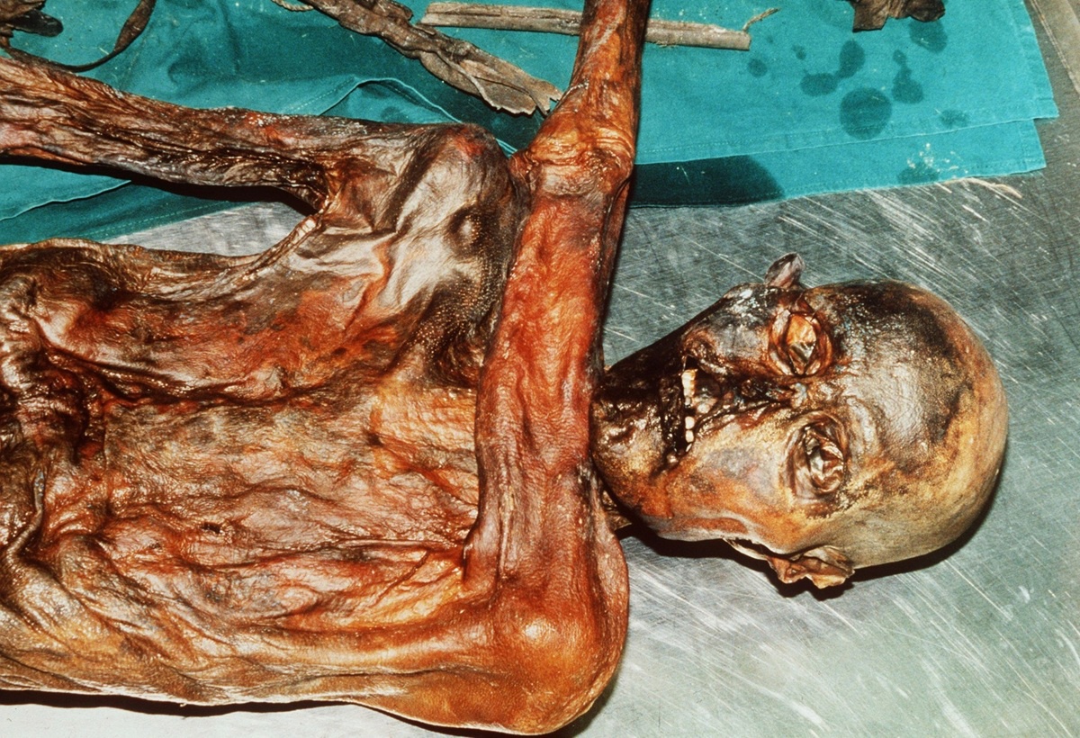 FOTO Na tijelu mumije stare 5300 godina i dalje žive mikrobi: "To je živi arhiv"