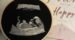 Slijepi budući tata dobio izvezenu fotografiju ultrazvuka da bi mogao vidjeti bebu