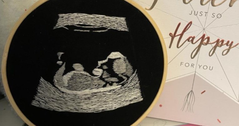 Slijepi budući tata dobio izvezenu fotografiju ultrazvuka da bi mogao vidjeti bebu