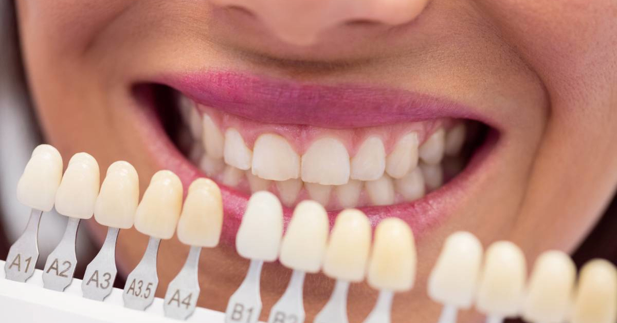 Stomatolozi upozoravaju: 6 svakodnevnih navika uništavaju bjelinu vaših zubi