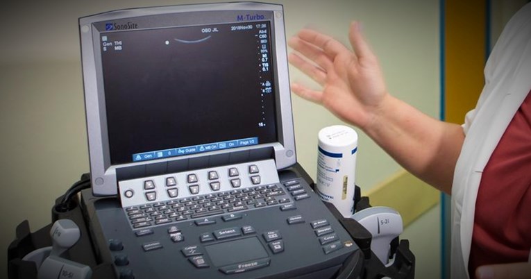 KBC-u Sestre milosrdnice doniran novi ultrazvučni aparat