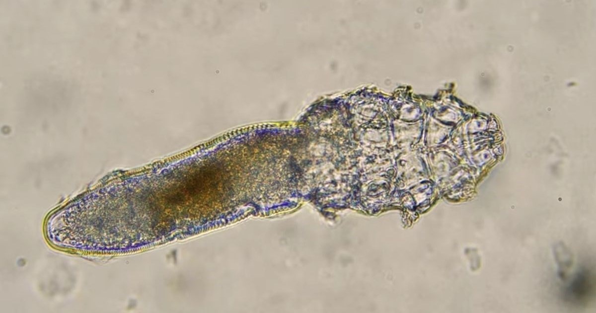 VIDEO Dok spavate, ovi paraziti partijaju na vašem licu