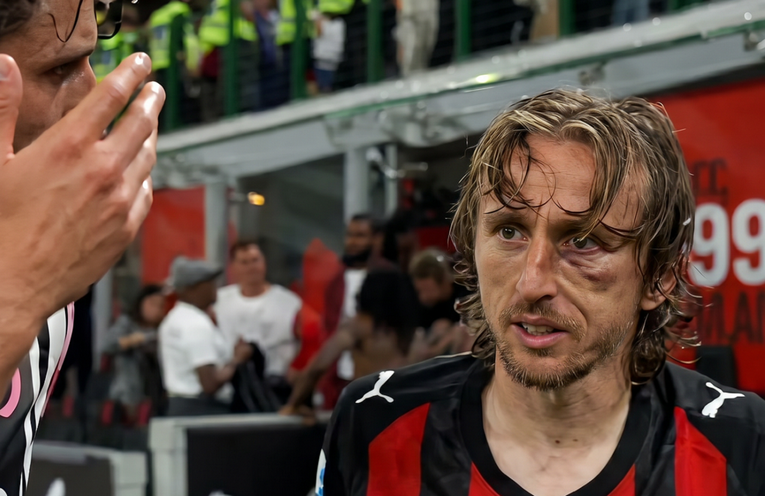 Pogledajte kako izgleda Modrićevo lice nakon žestokog sudara s kapetanom Juventusa